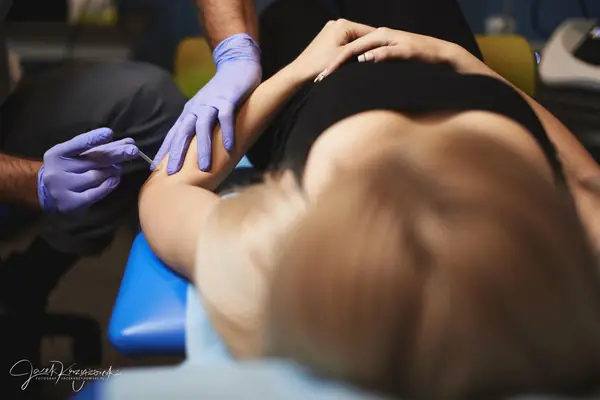Dry needling