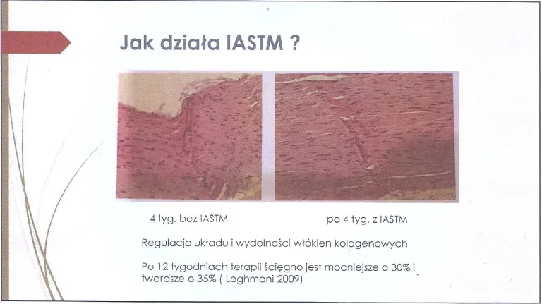 Jak działa IASTM - obraz mikroskopowy gojącego się więzadła